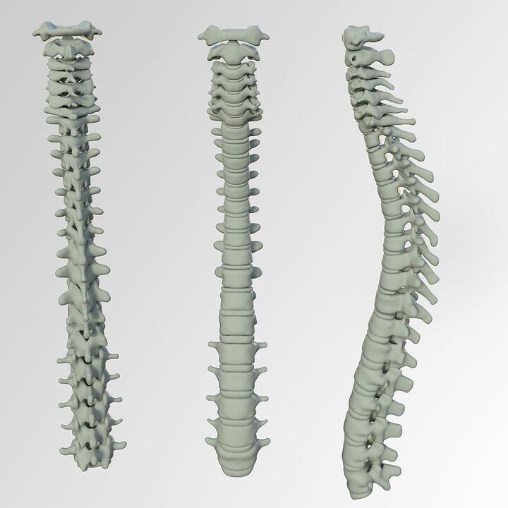 Spinal scheme